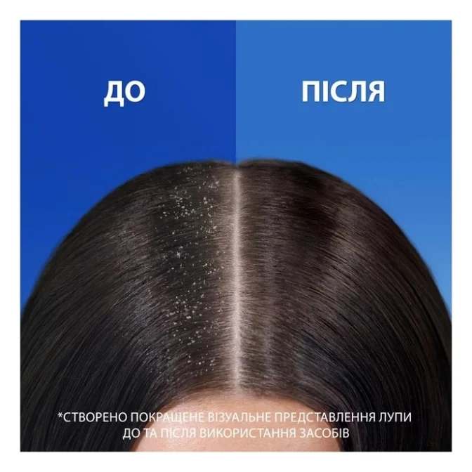 Шампунь Head & Shoulders Проти лупи Основний догляд 800 мл (8700216156134) — фото 3